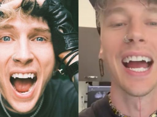 Machine Gun Kelly surpreende com mudança no visual ao exibir presas nos dentes