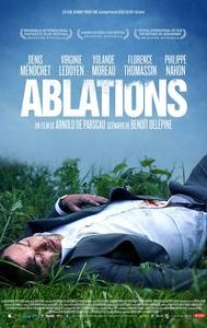 Ablations