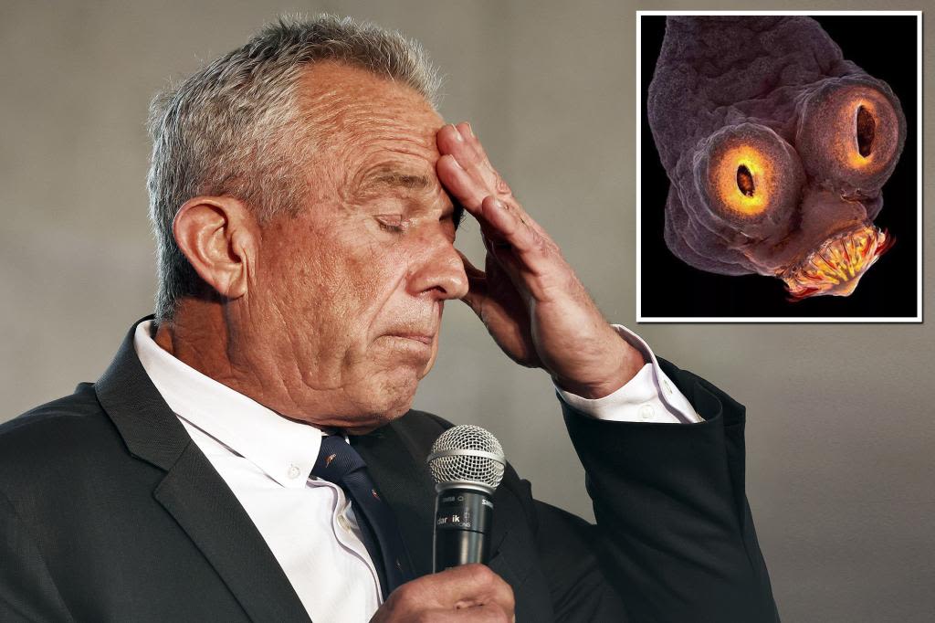 RFK Jr. said doctors found a dead worm in his head after it ate part of his brain