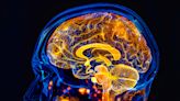 MIT’s New MRI Technique Reveals Hidden Light Deep in the Brain
