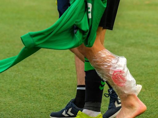 Isco, de jugar seguro la Eurocopa a seria duda en sólo unas horas: "No podía ni caminar"