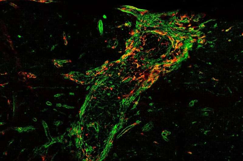 Scar formation after spinal cord injury is more complex than previously thought, scientists find