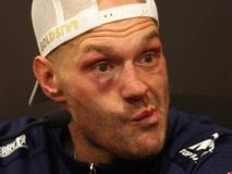 Tyson Fury 34-1-1 career boxing record IN FULL