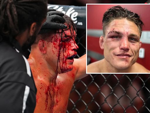 Watch UFC star bravely carry on fighting despite huge 'gross' cut to his eye