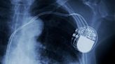 Abbott gains CE approval for dual-chamber leadless pacemaker