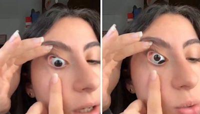 ¿Es real? Aseguró tener un "tercer ojo" y el impactante video se hizo viral