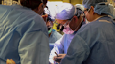 La startup detrás del primer trasplante de riñón entre cerdos y humanos ahora probará con el corazón y el hígado
