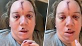 She suddenly passed out, leaving a huge scar. Doctors say it can happen to anyone