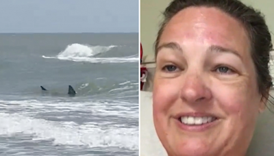 Texas South Padre Island shark attack survivor says her leg is ‘pretty much gone’