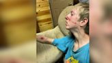 GRAPHIC: 15-year-old boy attacked by bear that got in family’s cabin