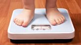 Surgery and medication included in treatment options for childhood obesity, new guidelines say