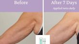 Amazon shoppers rave about £22 'miracle' anti-sagging arm cream