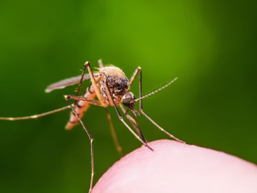 Can’t stop itching your mosquito bites? Here's how to get rid of the urge to scratch.