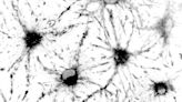 New tool provides researchers with improved understanding of stem cell aging in the brain