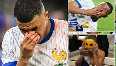 Kylian Mbappe likely to MISS Netherlands clash with broken nose