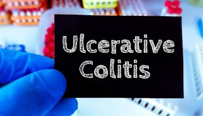 Managing Ulcerative Colitis Pain: Expert Lists Ways To Find Relief During Flares