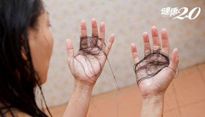 髮量告急？恐是「精血不足」警訊！醫揭露落髮調理方案 3招保養省錢又有效