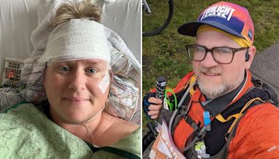 Stiff person syndrome patients share what it’s like to live with the rare disease