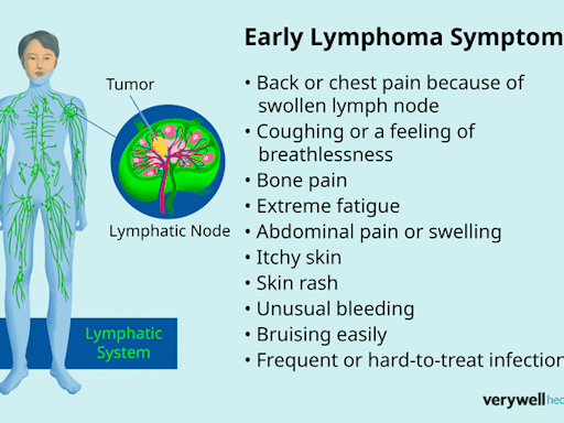 What Is Lymphoma, and Is It Serious?