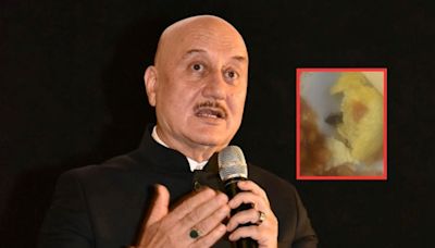 Anupam Kher Seeks Air India's Attention After His Student Finds...Cockroach In Omelette Served To 2-Yr-Old On Flight