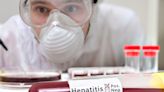Hepatitis aguda infantil: 10 dudas resueltas por un especialista médico