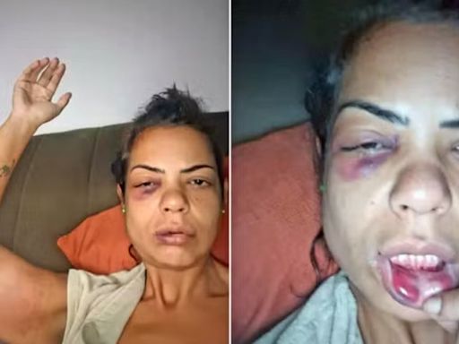 Professora é espancada por casal e arrastada por veículo após briga de trânsito; vídeo