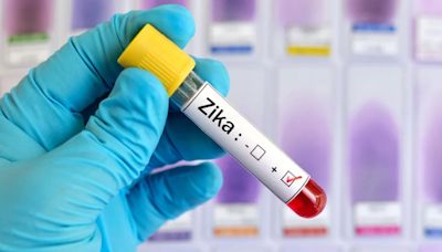 Descubren cómo el virus zika causa infección: usa al sistema inmune a su favor