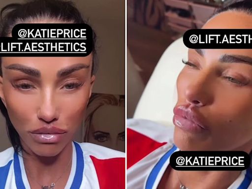 Katie Price gets her controversial ‘butterfly’ lips made even bigger