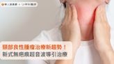 頸部良性腫瘤治療新趨勢！新式無疤痕超音波導引治療