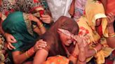 Hathras Stampede: Causes Of Death Range From Grievous Chest Injuries To Asphyxia, Autopsies Reveal