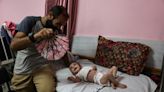 Dangerous skin diseases spreading among Gaza children