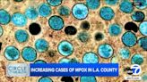 Mpox cases increase in LA County; health officials advise at-risk residents to take precautions