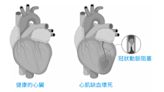 上班族注意》壓力大、常熬夜恐是「心肌梗塞」元凶！醫授6方法預防心梗：「這招」最便宜也最有效