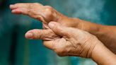 Drug treatment shows promise for preventing rheumatoid arthritis