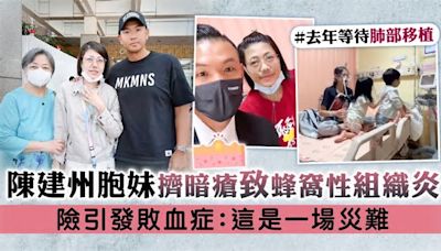 陳建州胞妹擠暗瘡致蜂窩性組織炎 險引發敗血症：這是一場災難