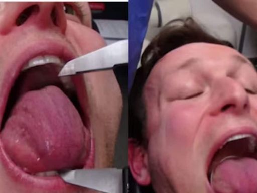This Belgium Man Has The Largest Tongue Circumference In The World - News18