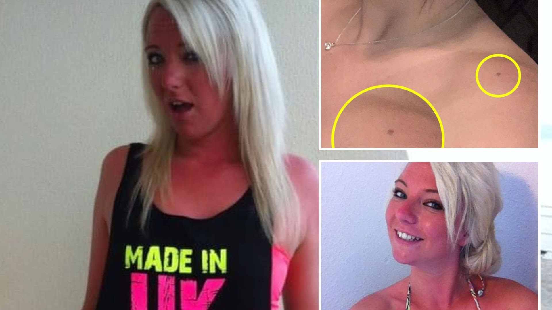 Mum who 'burnt bright red to tan can't go out in daylight' after diagnosis