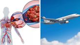 Do Frequent International Flyers Run The Risk Of Blood Clots? All About The Dangers Of Pulmonary Embolism