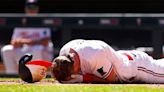 Twins SS Kyle Farmer to have teeth realigned after taking fastball to jaw