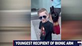 Young boy gets “Iron Man” bionic arm