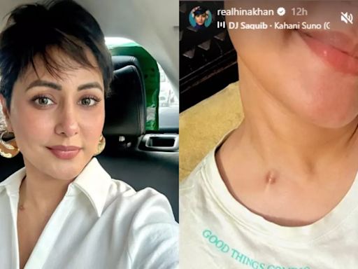 Hina Khan Bravely Shows Her Scars From Chemotherapy: ‘Good Things Coming’