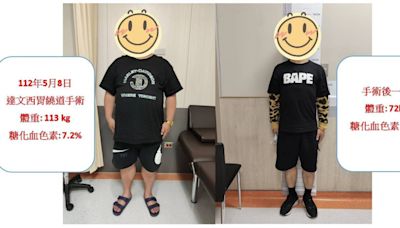 41歲男「月減40公斤」甩掉糖尿病 達文西手術