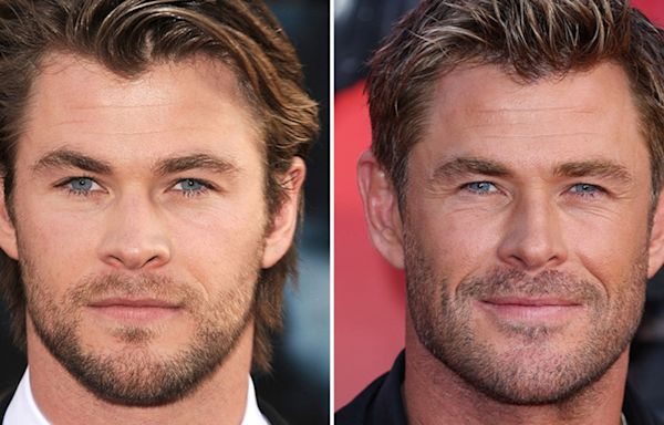 Chris Hemsworth -- Good Genes or Good Docs?!