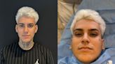 Filho de Andressa Urach faz cirurgia de orelha e admite: ‘Me sinto sexy’
