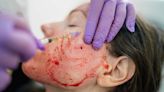Beware of ‘Vampire Facials’: 3 women tested positive for HIV after getting microneedling facial in US