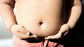 Children with severe obesity at age 4 may have a life expectancy of just 39: Study