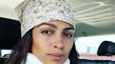 Camila Alves McConaughey Shares Pic of Neck Injury After Fall
