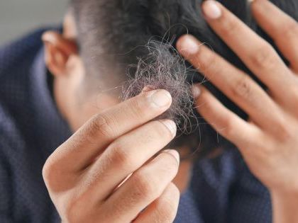 Estos son los peligros que te exponés por no lavarte el pelo en varios días, según una dermatóloga