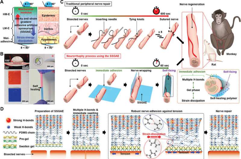 'Sticky and strain-gradient artificial epineurium' can heal severed nerves in only one minute, study claims