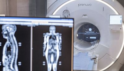 Celebrities are getting $2,000 MRI scans to learn about their health. Should you?